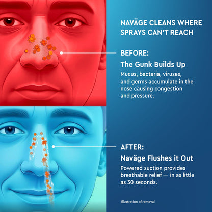 Nose Cleaner