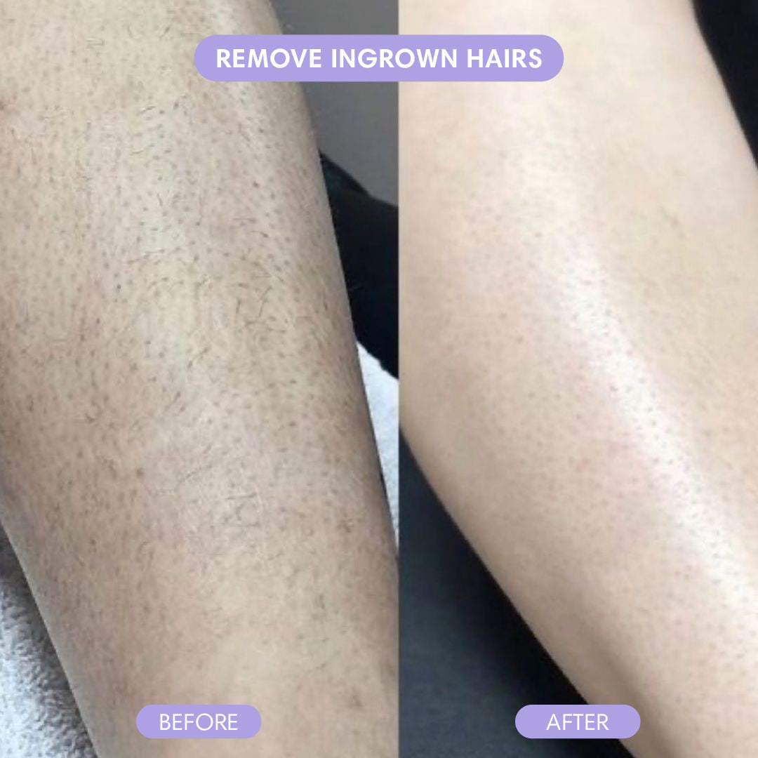 Crystal Hair Eraser – Painless Hair Removal for Smooth Skin