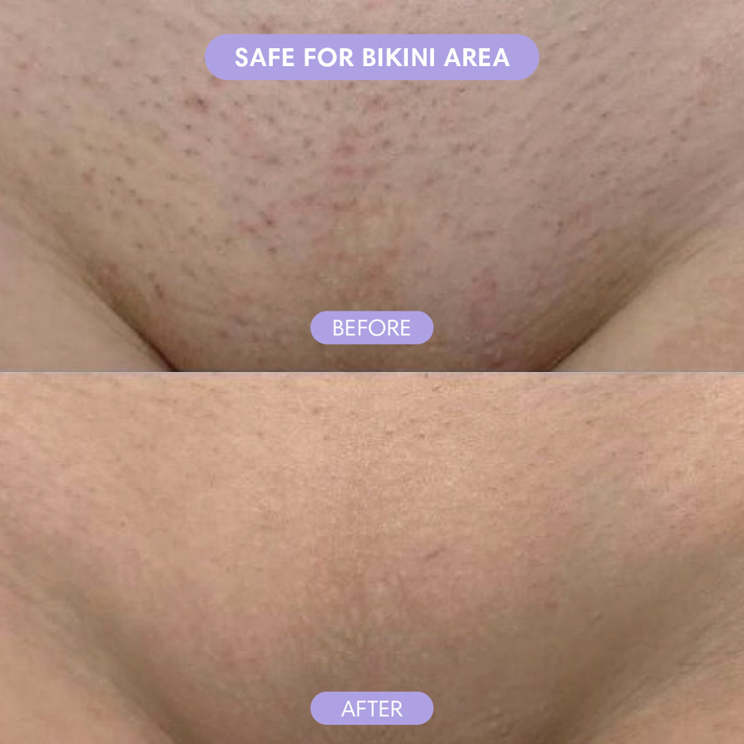 Crystal Hair Eraser – Painless Hair Removal for Smooth Skin