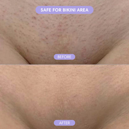 Crystal Hair Eraser – Painless Hair Removal for Smooth Skin