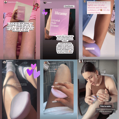 Crystal Hair Eraser – Painless Hair Removal for Smooth Skin